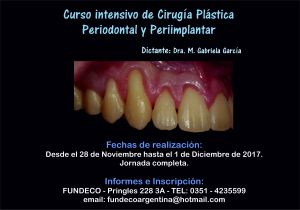 noticia